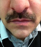 Movember